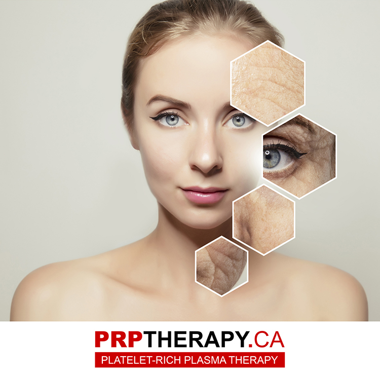PRP Treatment - PRP Therapy - PRP Hair Treatment