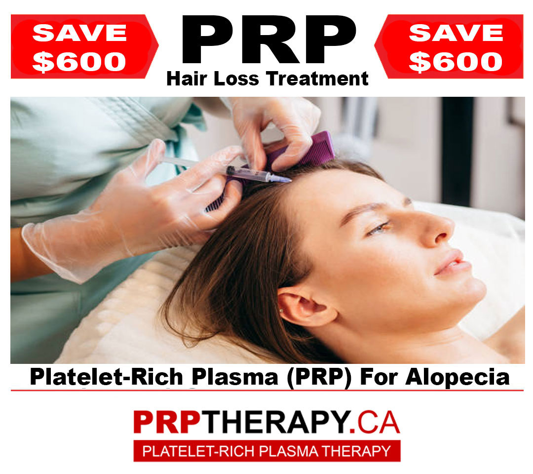 PRP in hair treatment - PRP Toronto - PRP hair treatment